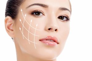 preenchimento na harmonização facial