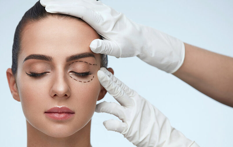 como acabar com a Flacidez De Palpebra