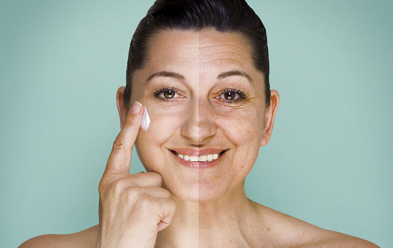 Veja Tratamento Para Melanose Solar